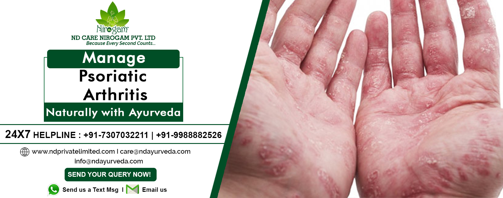 Ayurvedic psoriatic Treatment